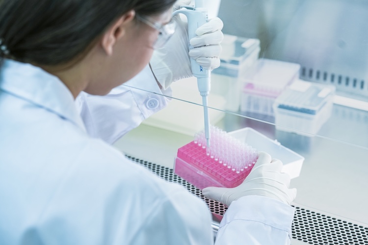 Metabolism of S-adenosylmethionine and protein arginine methylation in cancer